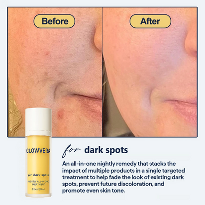 Radiant Glow Brightening Serum™
